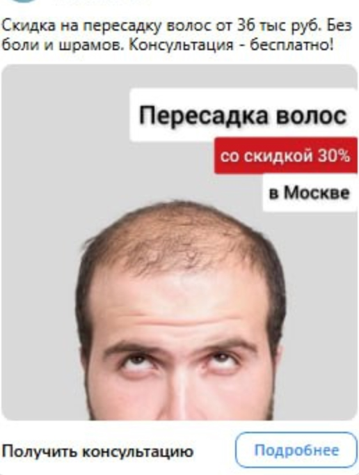 Рекламный креатив клиники пересадки волос